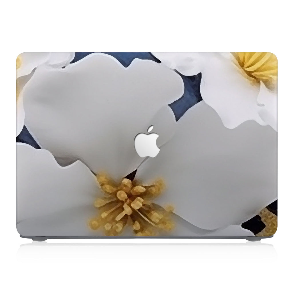 This lightweight, slim hardshell with Artistic Flower design is easy to install and fits closely to protect against scratches