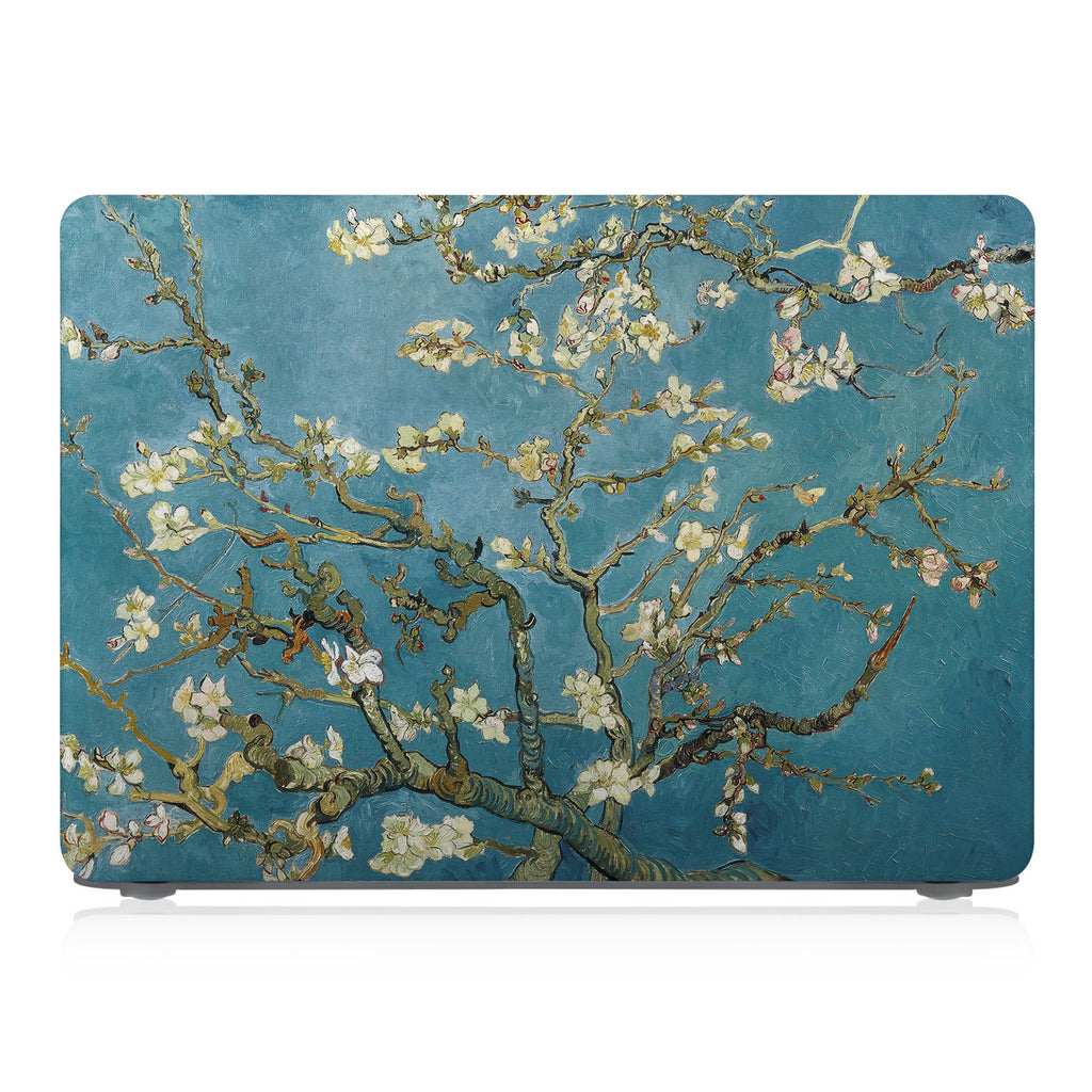 Macbook Case - Positive Quote - You Are Your Only Limit