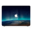 Macbook Case - Nature Wonder