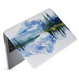 hardshell case with Watercolor View design has matte finish resists scratches